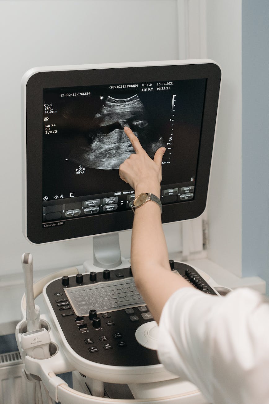 a person pointing on an ultrasound